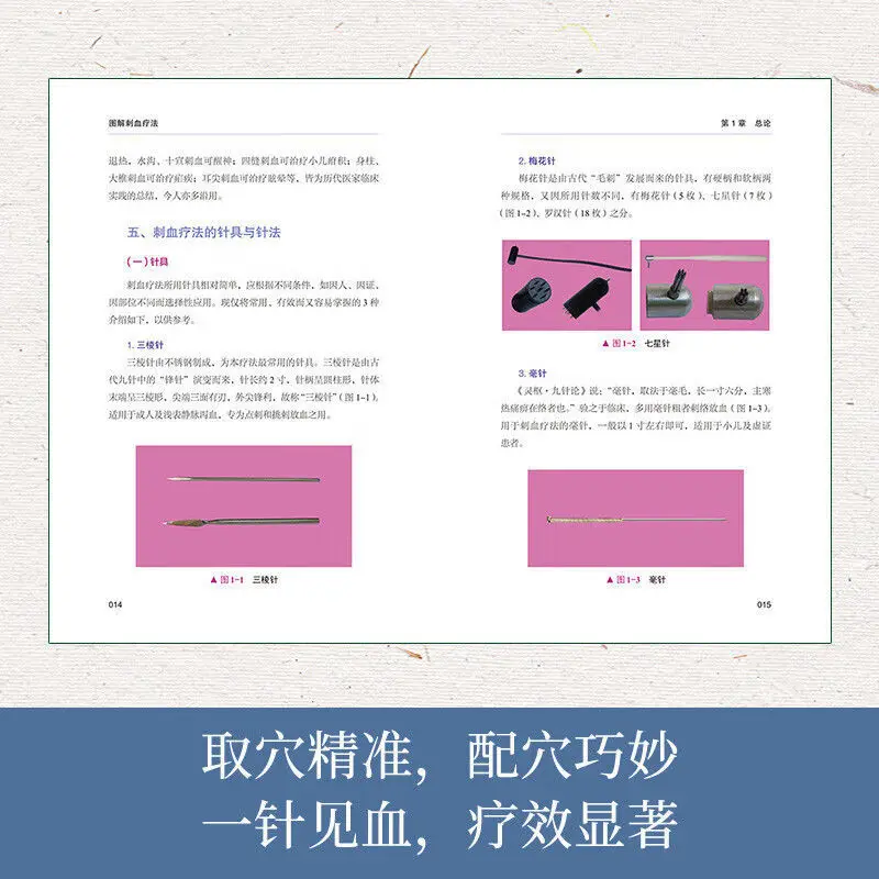 Therapy Health And Wellness - 「放血療法」について解説：健康とウェルネスのための伝統中国医学（TCM）ガイドと医学事典（図解付き）